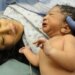 Mortalidade materna: Brasil ainda perde centenas de mulheres por ano